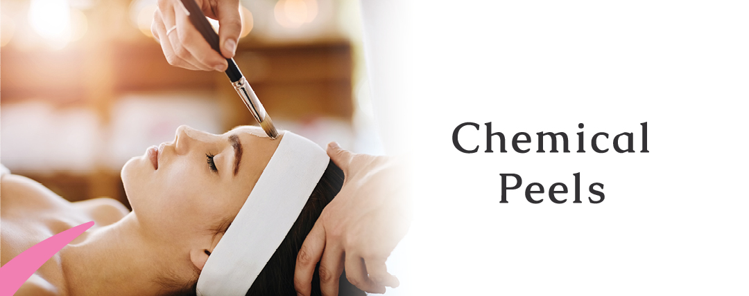 Chemical Peels